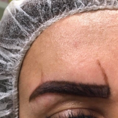 fabulous-Mervat-Ghazi-Microblading2-estaetix