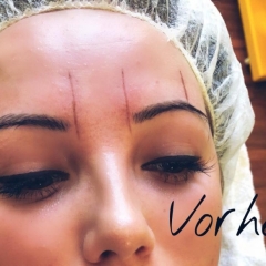 fabulous-Mervat-Ghazi-Microblading4-estaetix
